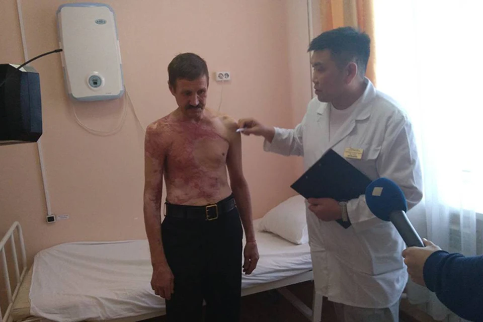 Врачи из Бурятии спасают пациентов, заменяя им сожженную кожу искусственной.Фото: Елена Амоголонова, БСМП.
