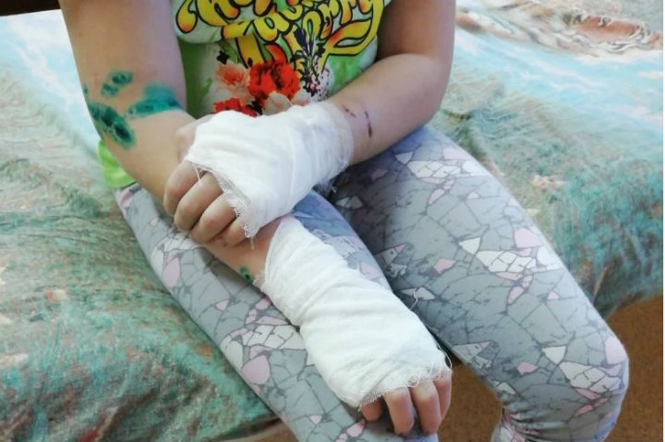 Напала сзади и начала рвать: взбесившаяся хаски прокусила руки и ноги 9-летней девочке из Братска. Фото: предоставлено Анной Мазитовой.