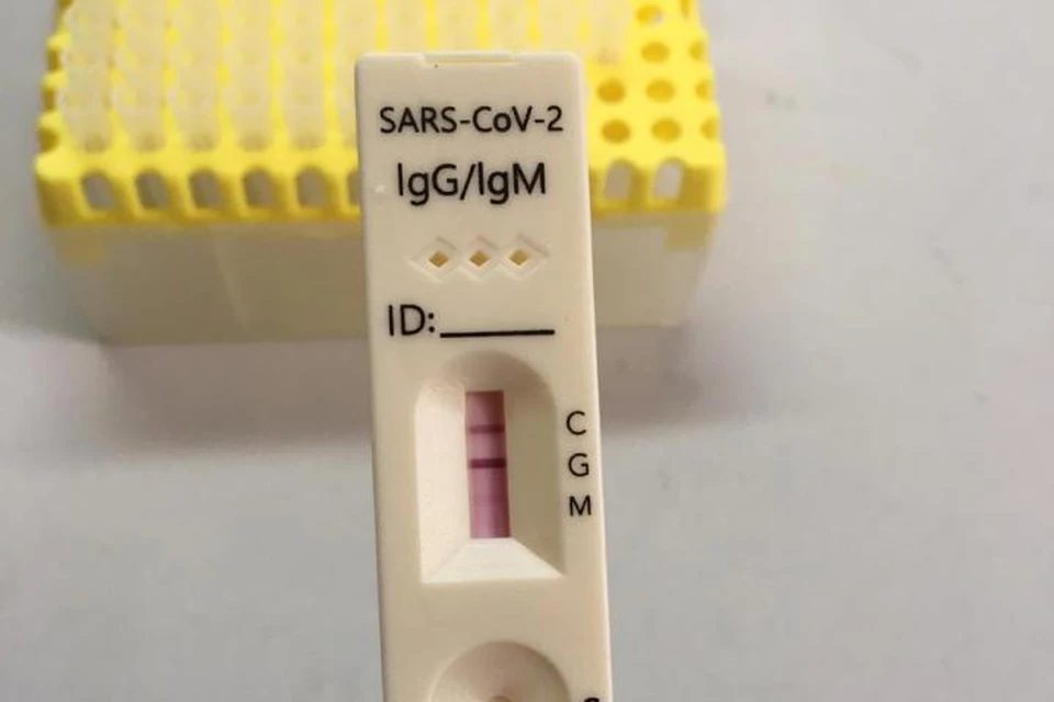 Тесты на антитела к коронавирусу начали делать в Кузбассе. Фото: Министерство здравоохранения Кузбасса