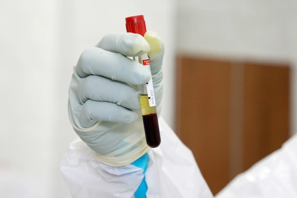 Еще 126 человек в Кузбассе заразились коронавирусом