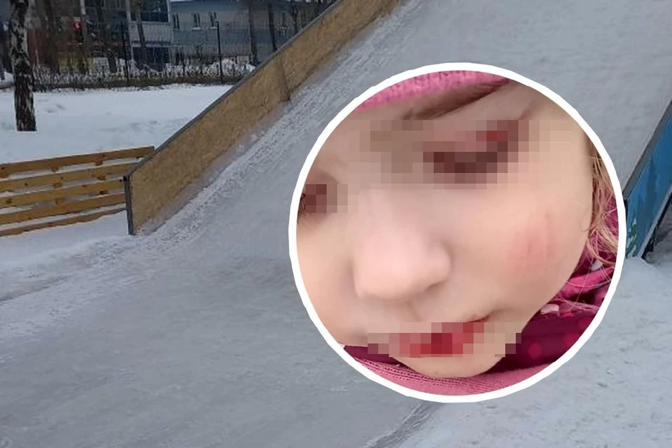 По словам мамы, на горке есть яма. Фото: «Инцидент. Новосибирск»