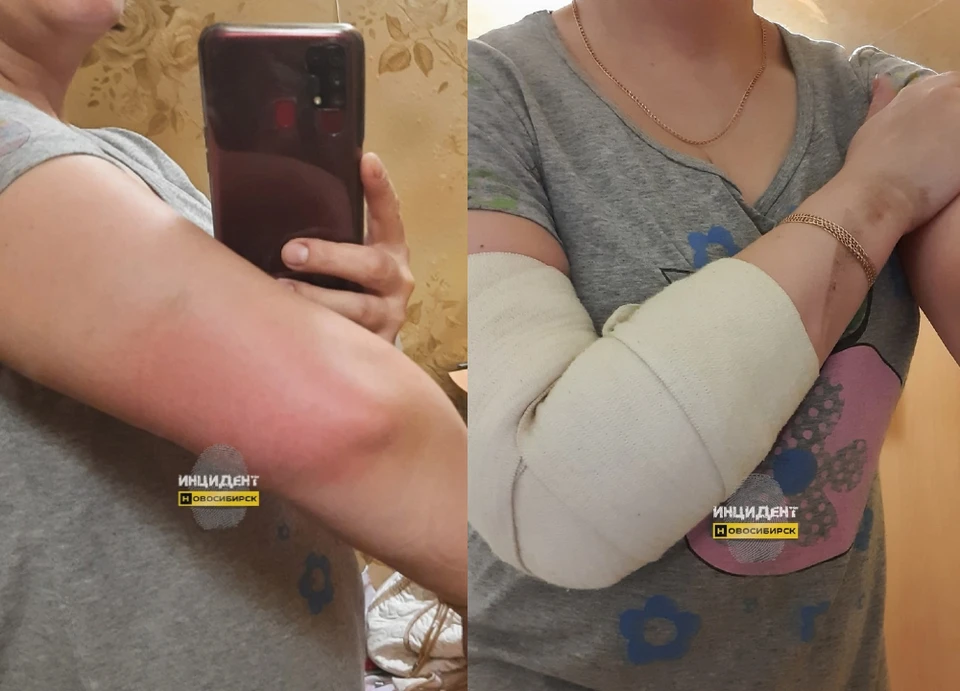 Девушка обратилась в травмпункт и теперь ищет виноватых. Фото: сообщество «Инцидент-Новосибирск» «ВКонтакте»