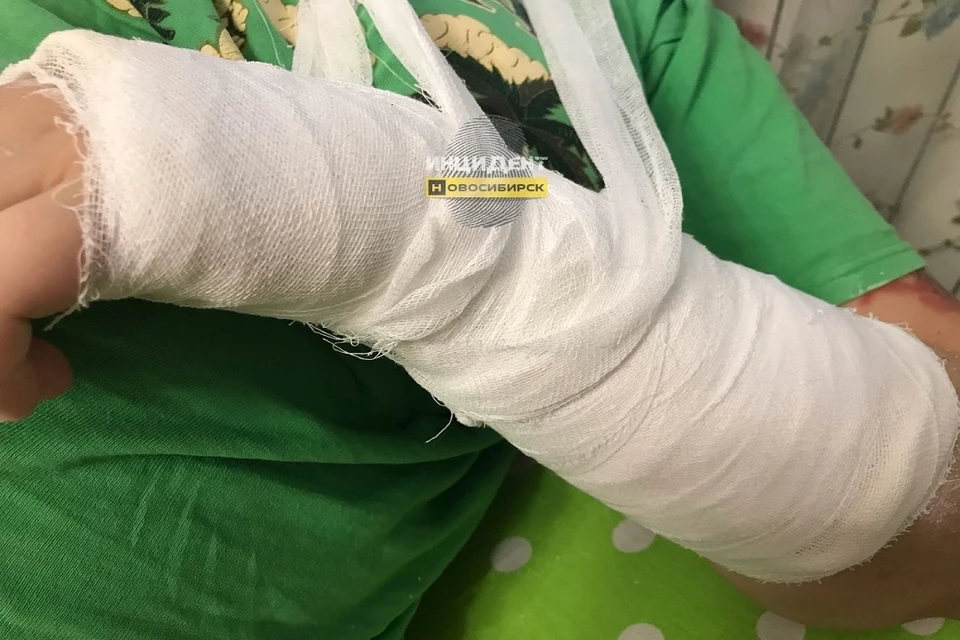 В Новосибирске девушка сломала руку, поскользнувшись на гололеде. Фото: "Инцидент Новосибирск".