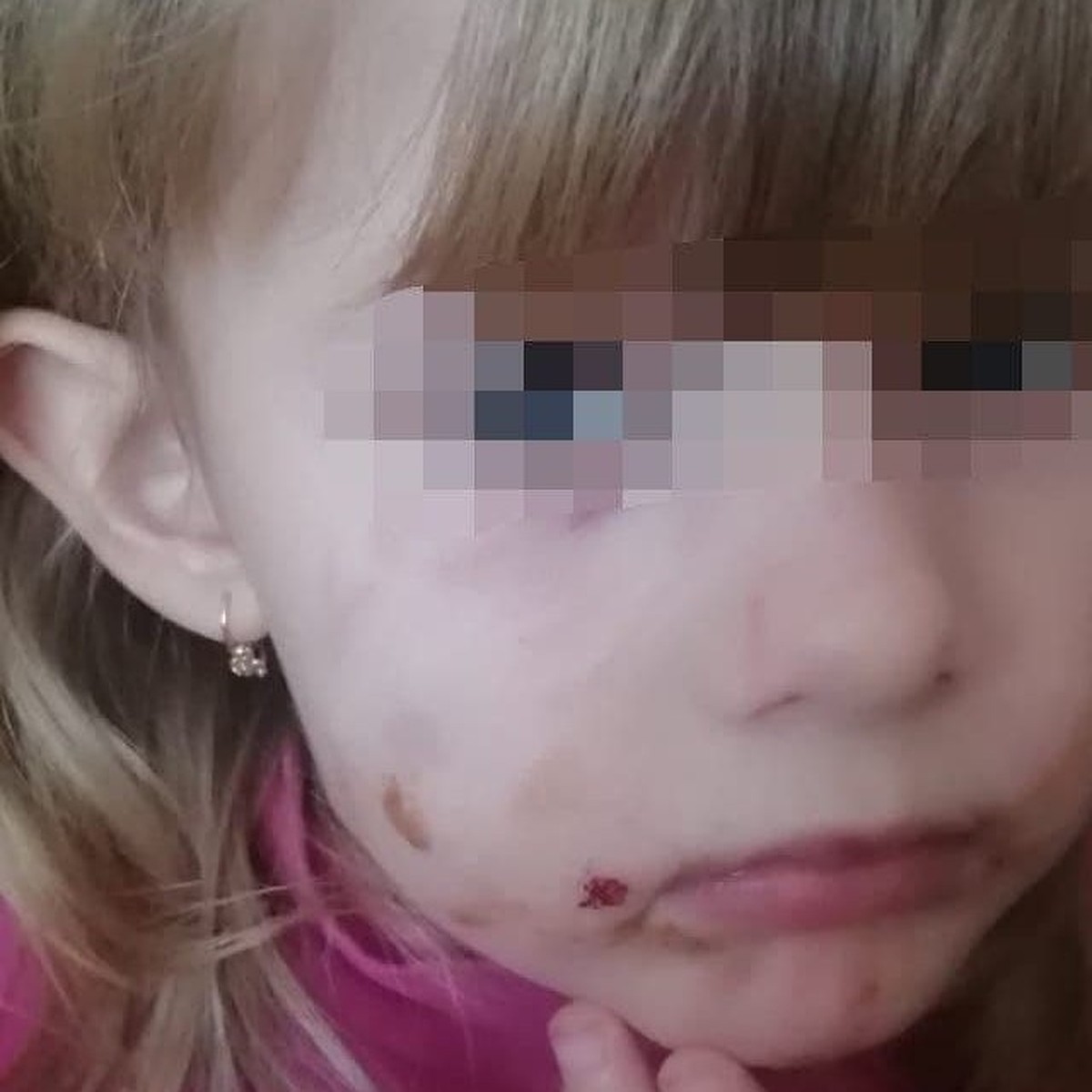 На Сахалине бездомная собака покусала за лицо 4-летнюю девочку - KP.RU