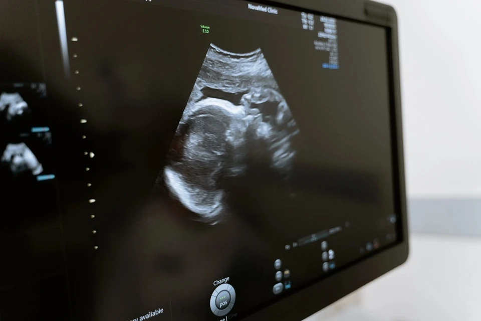 В Минске беременной пациентке сделали внутриутробную операцию из-за порока развития плода. Фотоиллюстрация: pexels.com