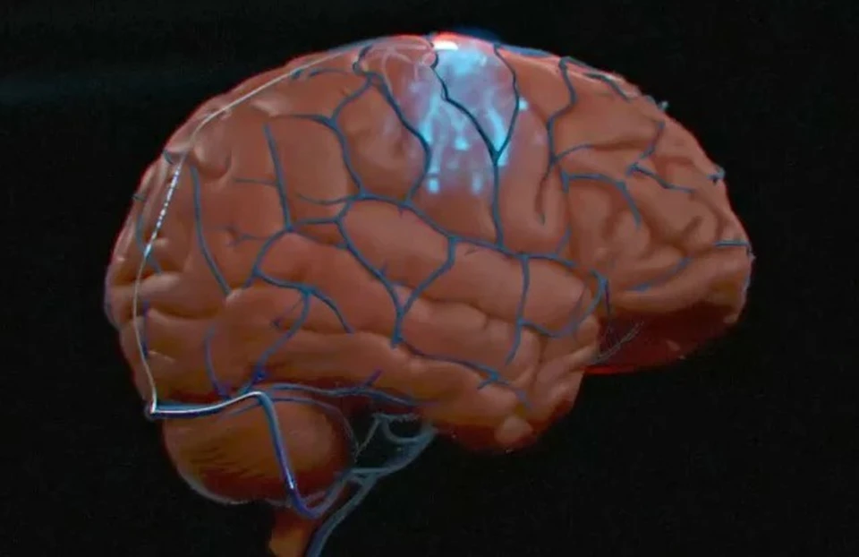 Компания Synchron осуществила успешную операцию на мозге у парализованного пациента, внедрив ему компьютерный чип.