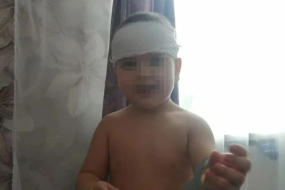 Следователи проверят, почему мальчику с разбитой головой отказались помочь в двух больницах. Фото: предоставлено Екатериной.