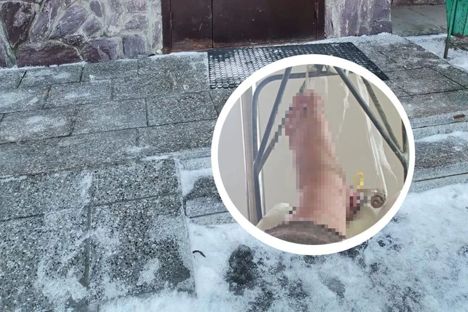 Сибирячка попала в больницу с переломами двух костей голеностопа. Фото: предоставлены родственниками потерпевшей