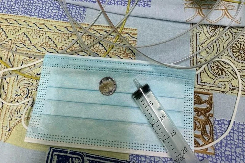 Батарейку из пищевода 3-летней девочки извлекли врачи в Туапсе. Фото: Туапсинские вести