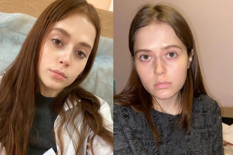 «Дочка кричала от боли»: в новосибирской больнице умерла девушка, отсудившая у минздрава лекарство за 50 миллионов