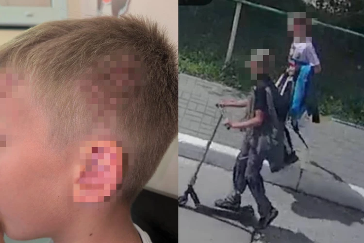 «Били, пока сын не потерял сознание»: в Новосибирске подростки напали на 9-летнего футболиста