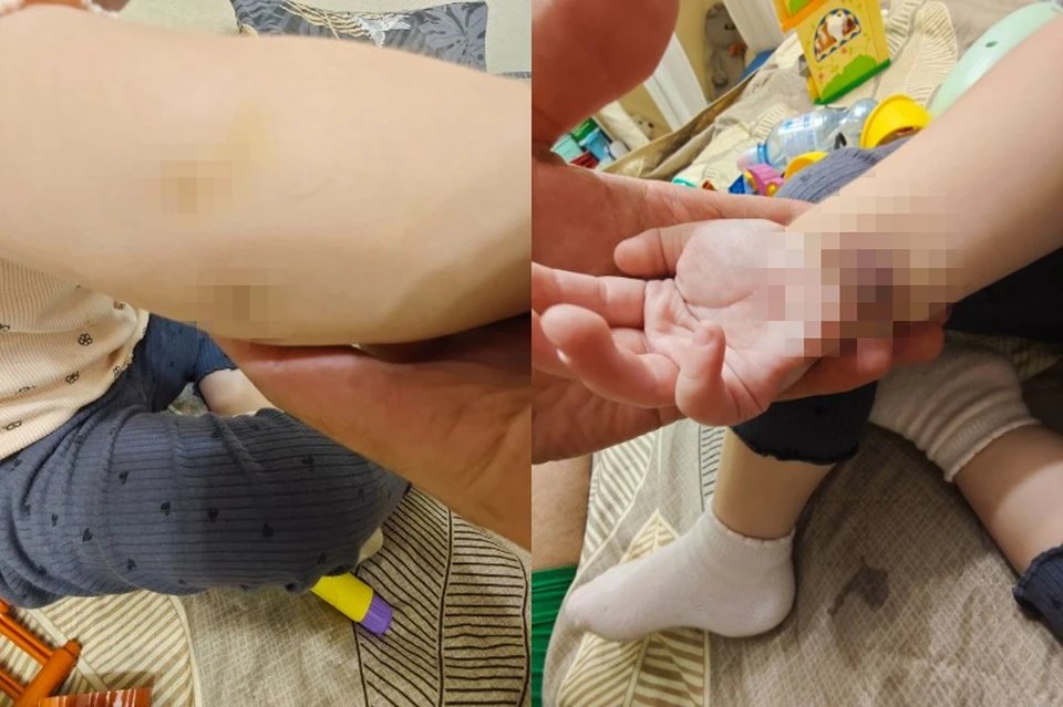 Девочка играла на кровати упала. Фото: предоставлено семьей ребенка