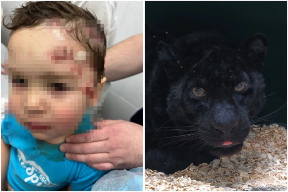 Ровно год назад пантера напала на мальчика во время фотоссесии. Фото: предоставлено мамой пострадавшего мальчика/Иркутская зоогалерея.