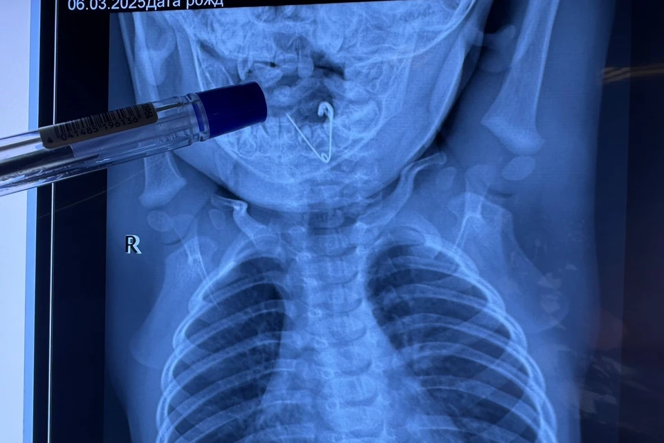 Мама мальчика провела в тревоге почти 8 часов. Фото: telegram-канал «Детское здравоохранение Приморья»