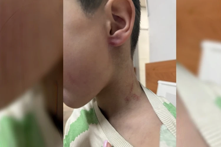 Схватил за шею и поднял в воздух: тренер жестоко обращался с ребенком в детском саду Иркутского района