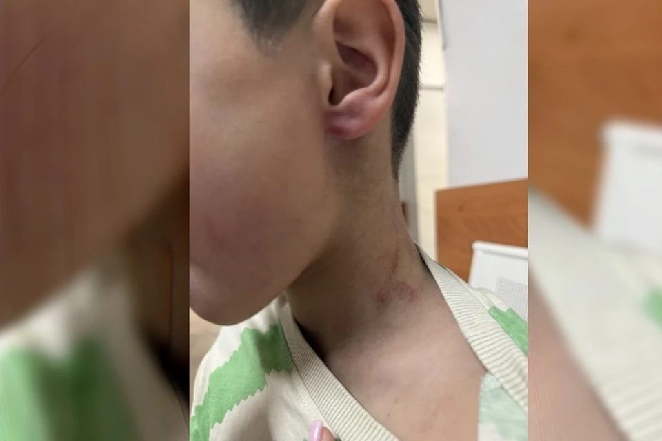 В детском саду поселка Молодежный тренер нанес ребенку травмы головы и лица. Фото: социальные сети межрегионального центра по правам детей