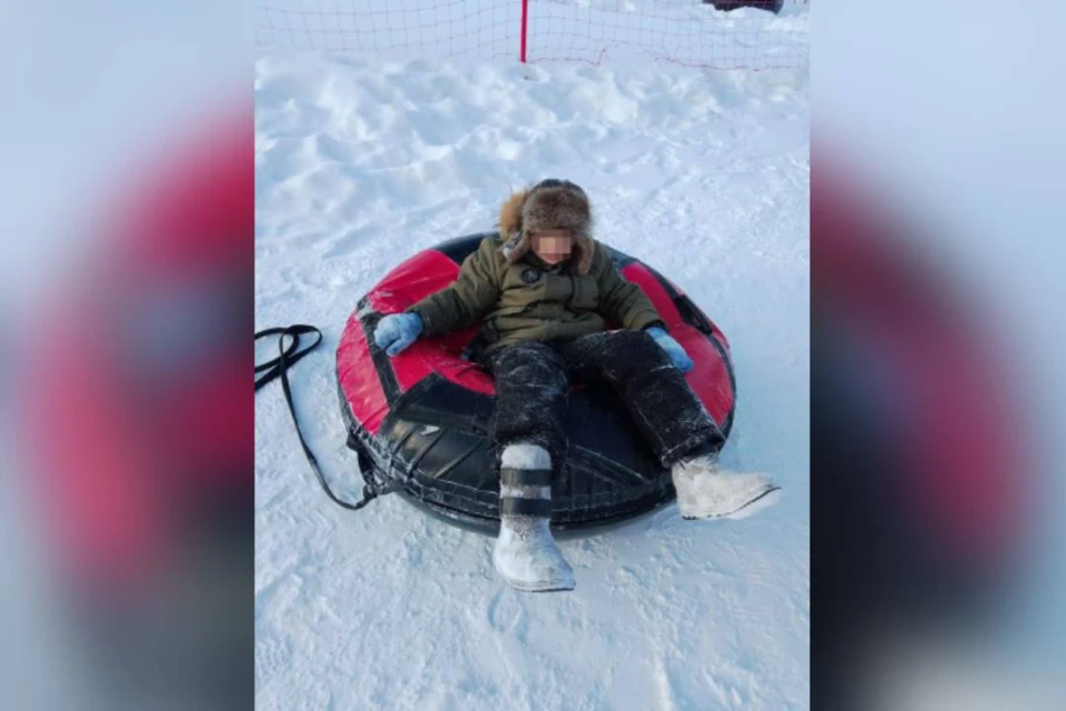 Ребенок получил тяжелый перелом большеберцовой кости со смещением. Фото: из личного архива героев публикации