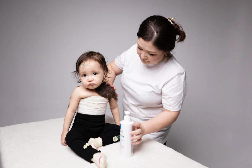 Мерейлим родилась с родинкой на 80% тела. Фото: личный архив семьи