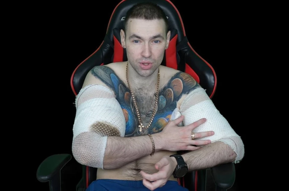 Это была третья операция на руки у Кирилла. Фото: социальные сети Кирилла Терешина