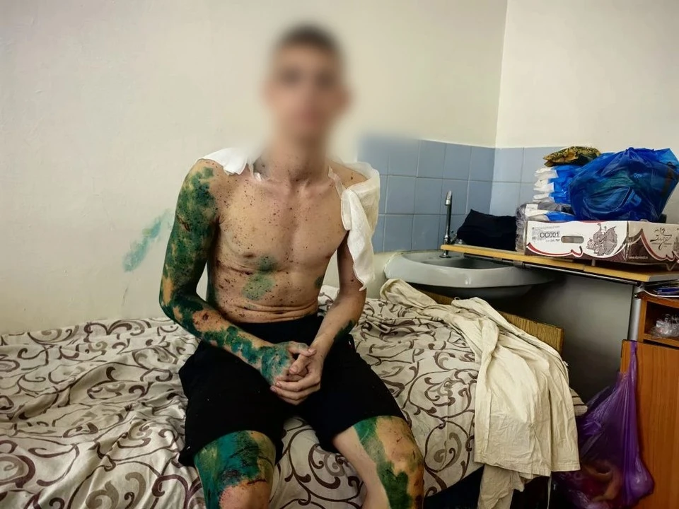 Студент при ударе ВСУ по Старобельску упал с пятого этажа и чудом выжил