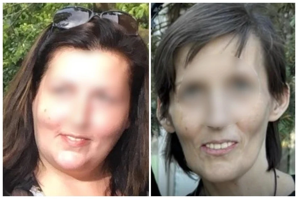 Врачи спасли ростовчанку, в организме которой скопилось 35 литров жидкости. Фото: из архива героя публикации