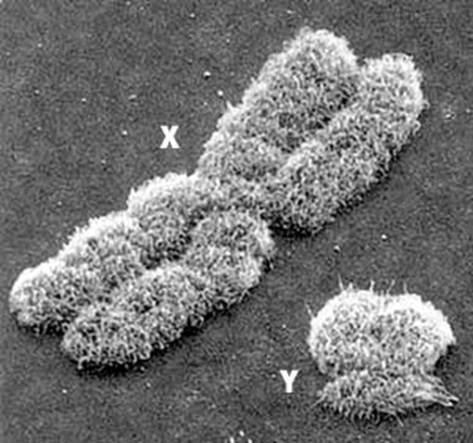 Электронная микрофотография X- и Y-хромосомы человека. Увеличение - 10 тысяч раз