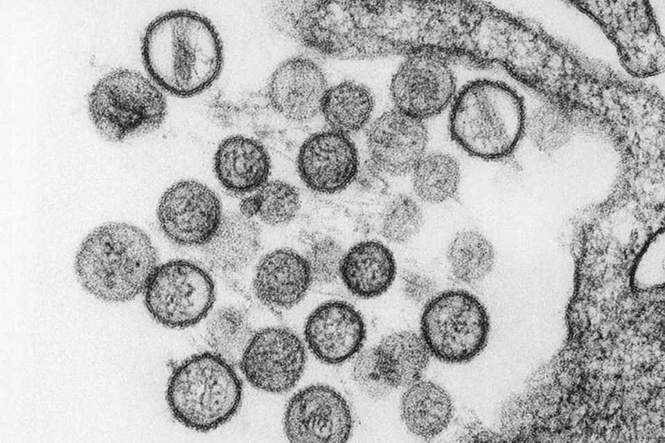 Хантавирусом могли заразиться более 20 тысяч человек