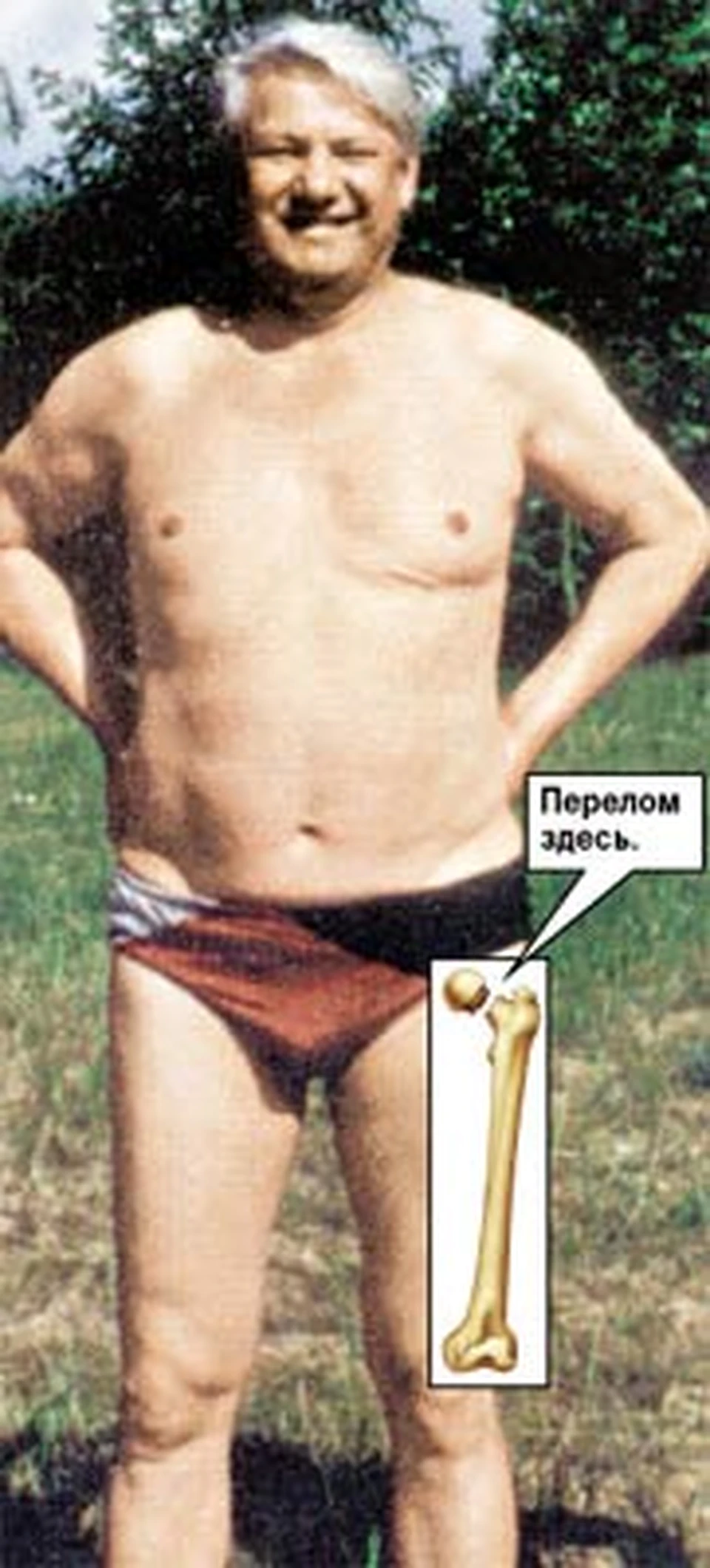 Перелом здесь.
