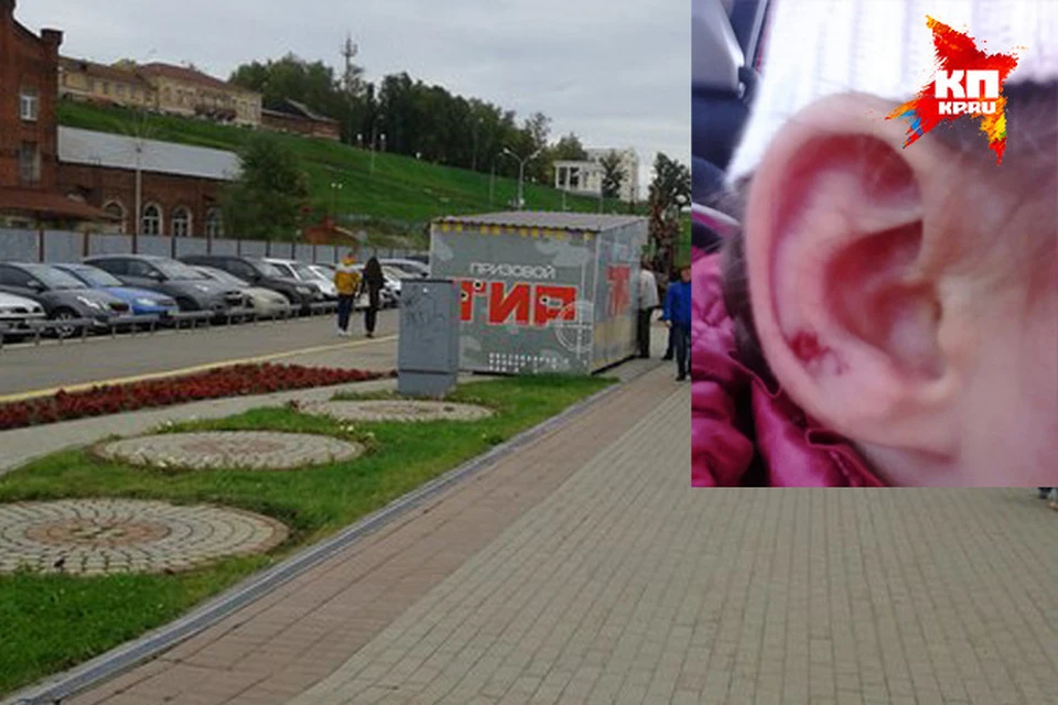В Ижевске возбудили уголовное дело на владельца тира, около которого девочке в ухо попала пуля
