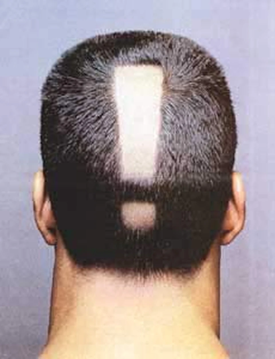 Как не облысеть в жару - KP.RU