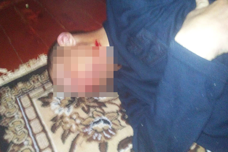 Подростки сфотографировали избитого мужчину и выложили снимки в сеть.